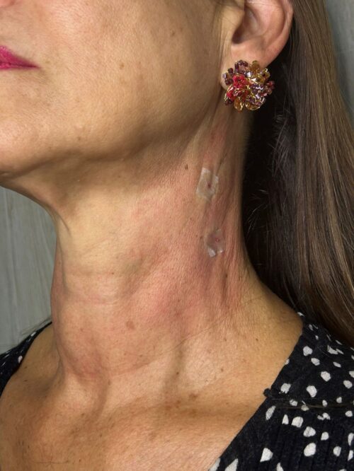 Cópia de Depois (1)